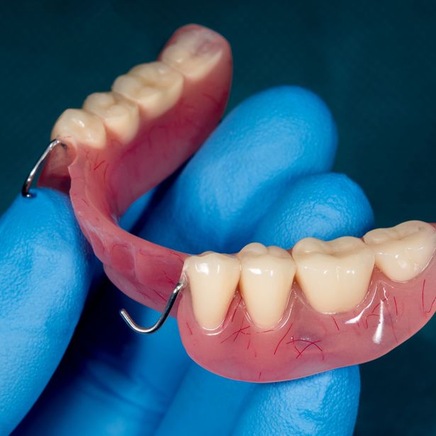Partial denture being held by a hand
