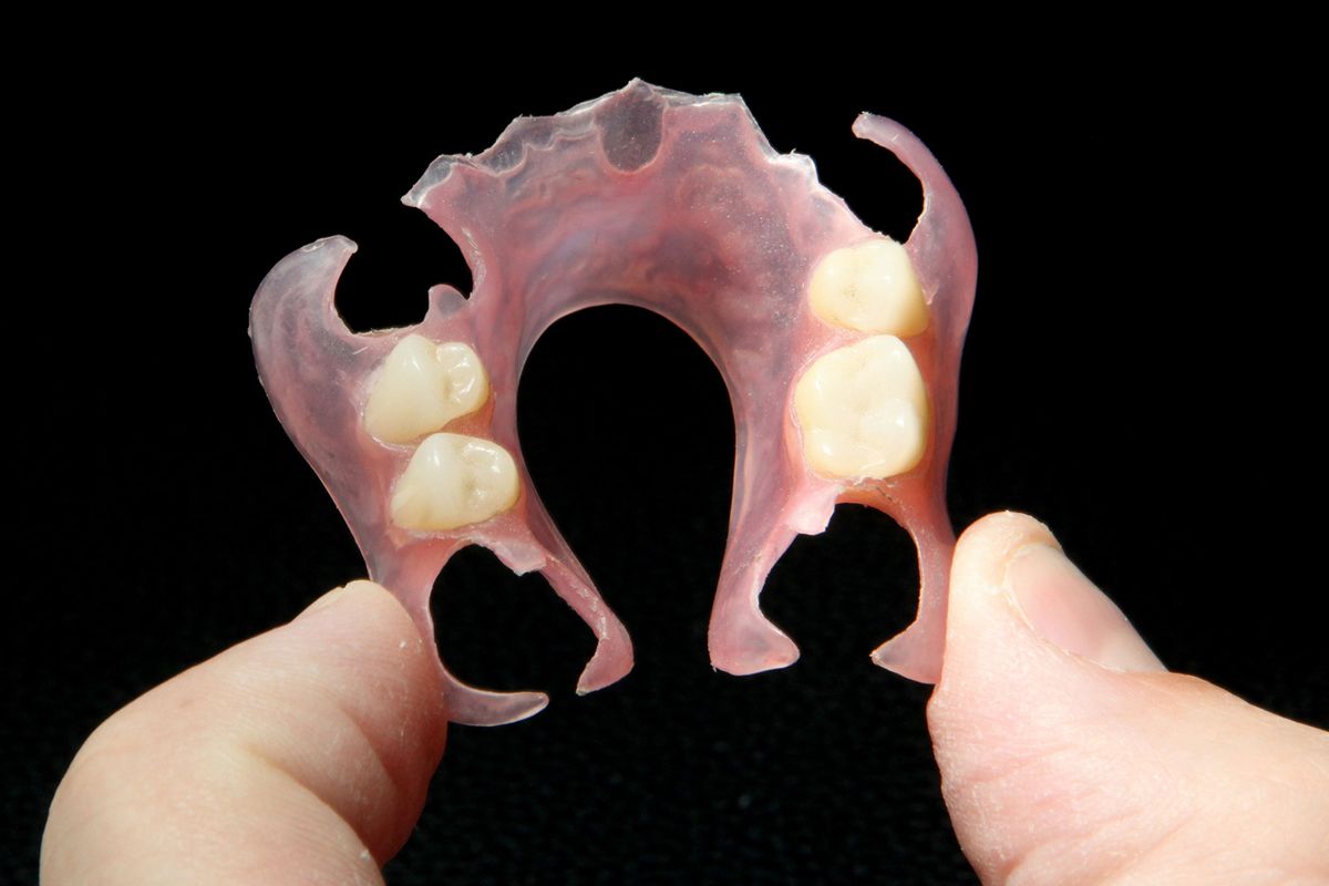 Flexible Partial Denture featured image