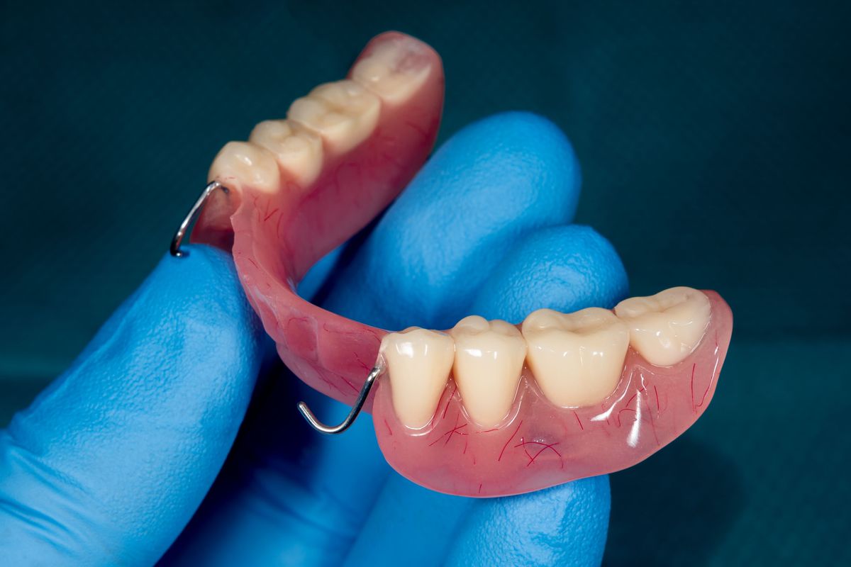 Acrylic Partial Denture featured image